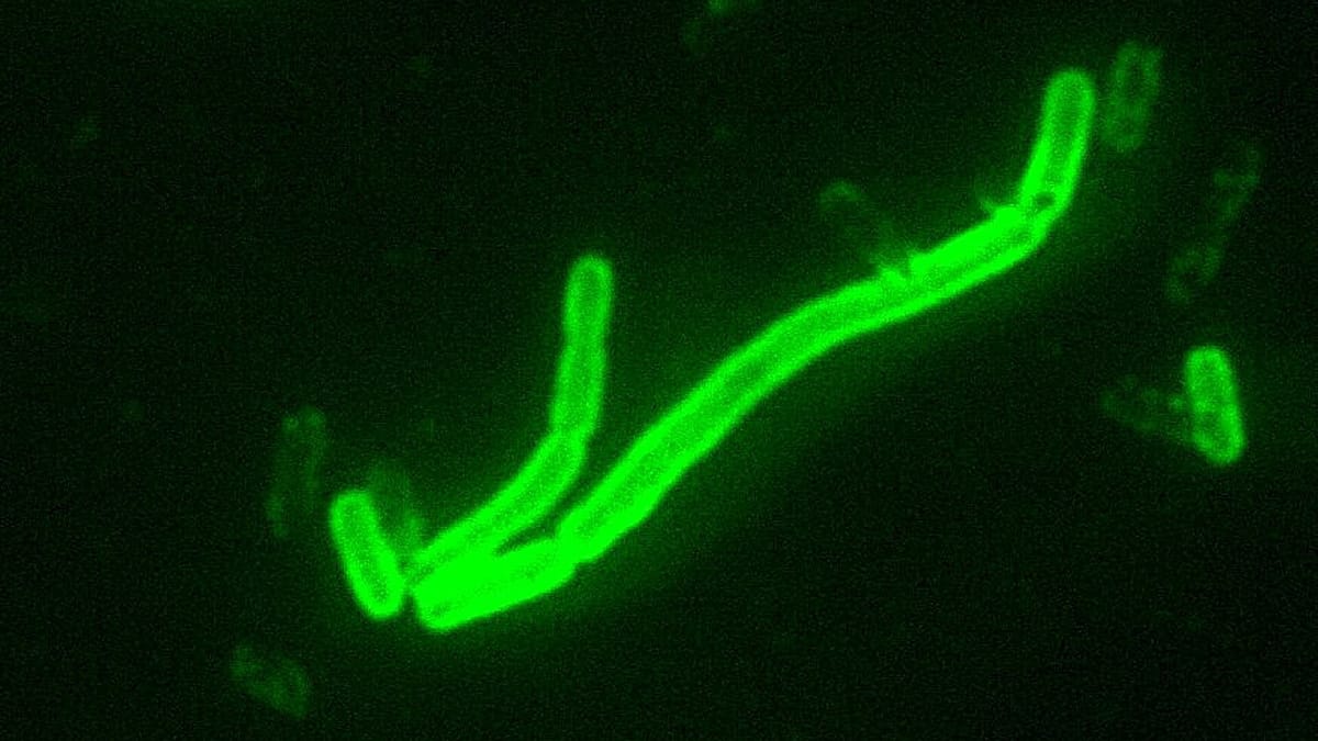 Bacterias Yersinia pestis, causantes de la peste, vistas al microscopio con tinción fluorescente verde.